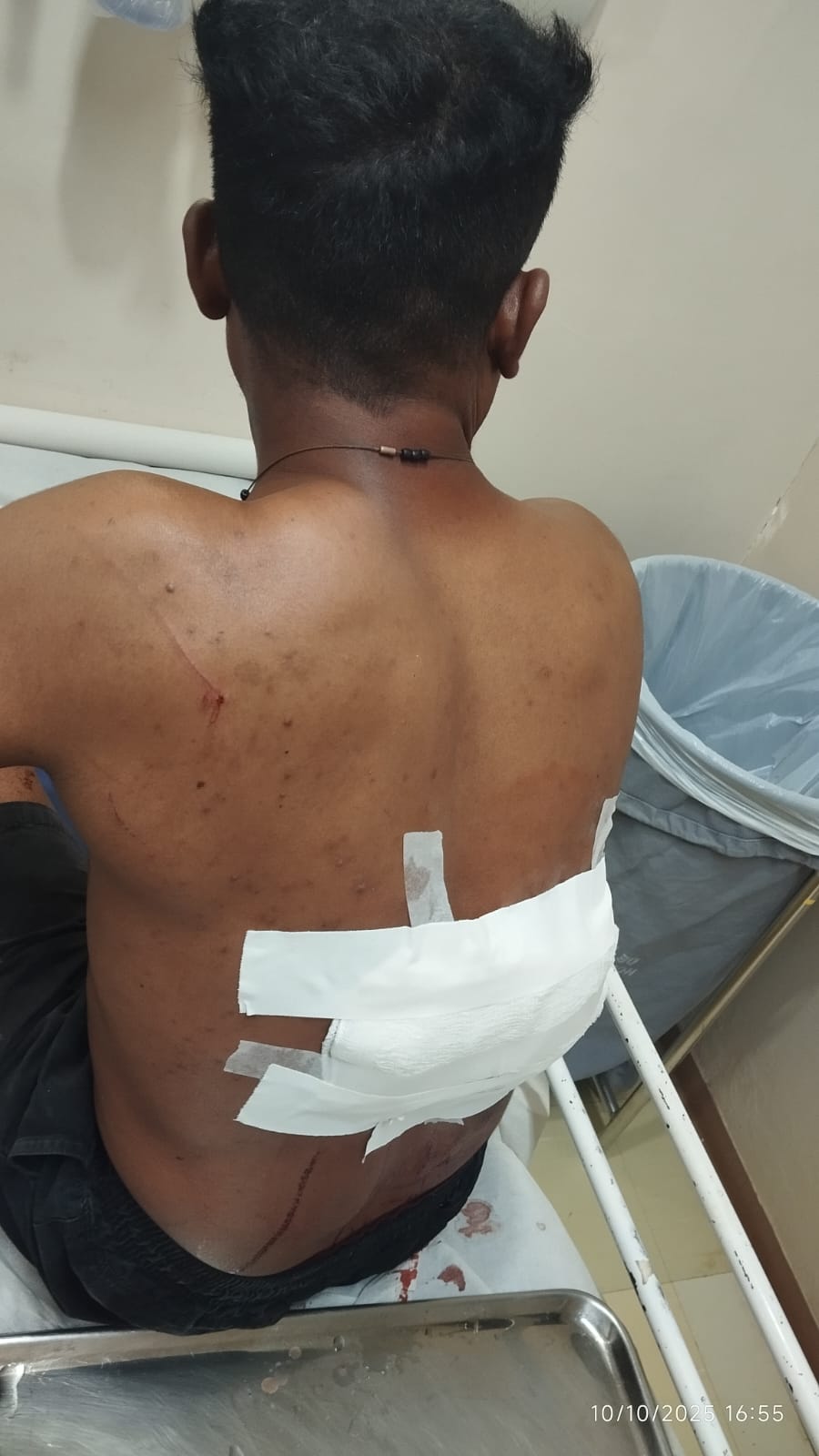 Mecânico é esfaqueado em oficina após discussão sobre garantia em Tailândia (PA)